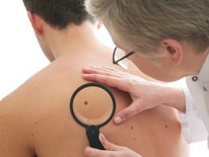 Hautkrebsscreening